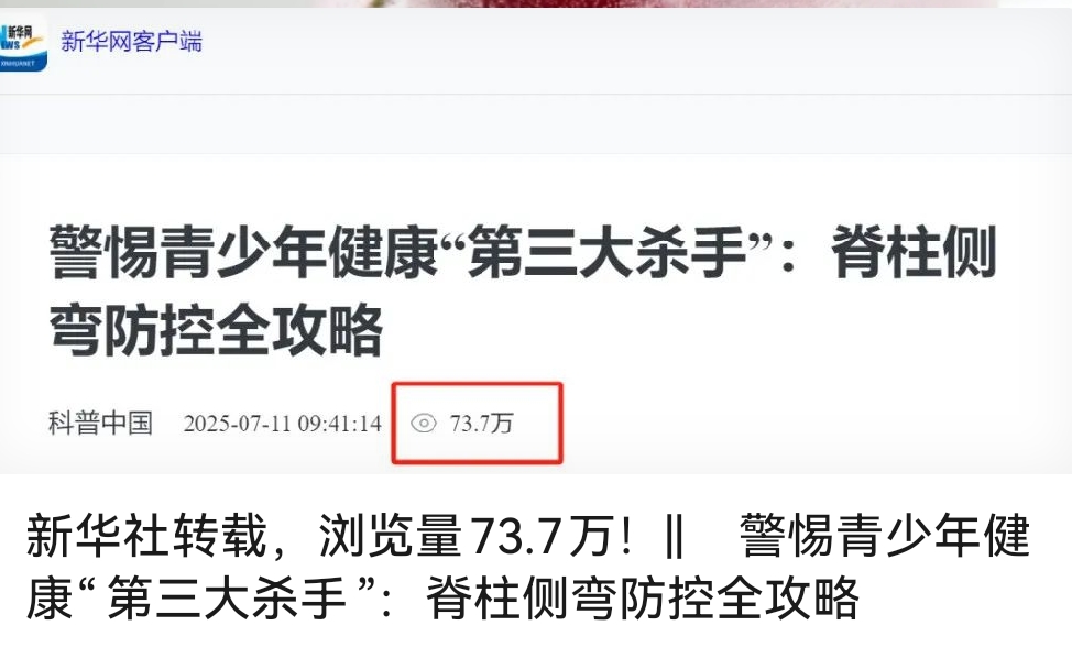 “新华社转载，浏览量73.7万！|| 警惕青少年健康“第三大杀手”：脊柱侧弯防控全攻略